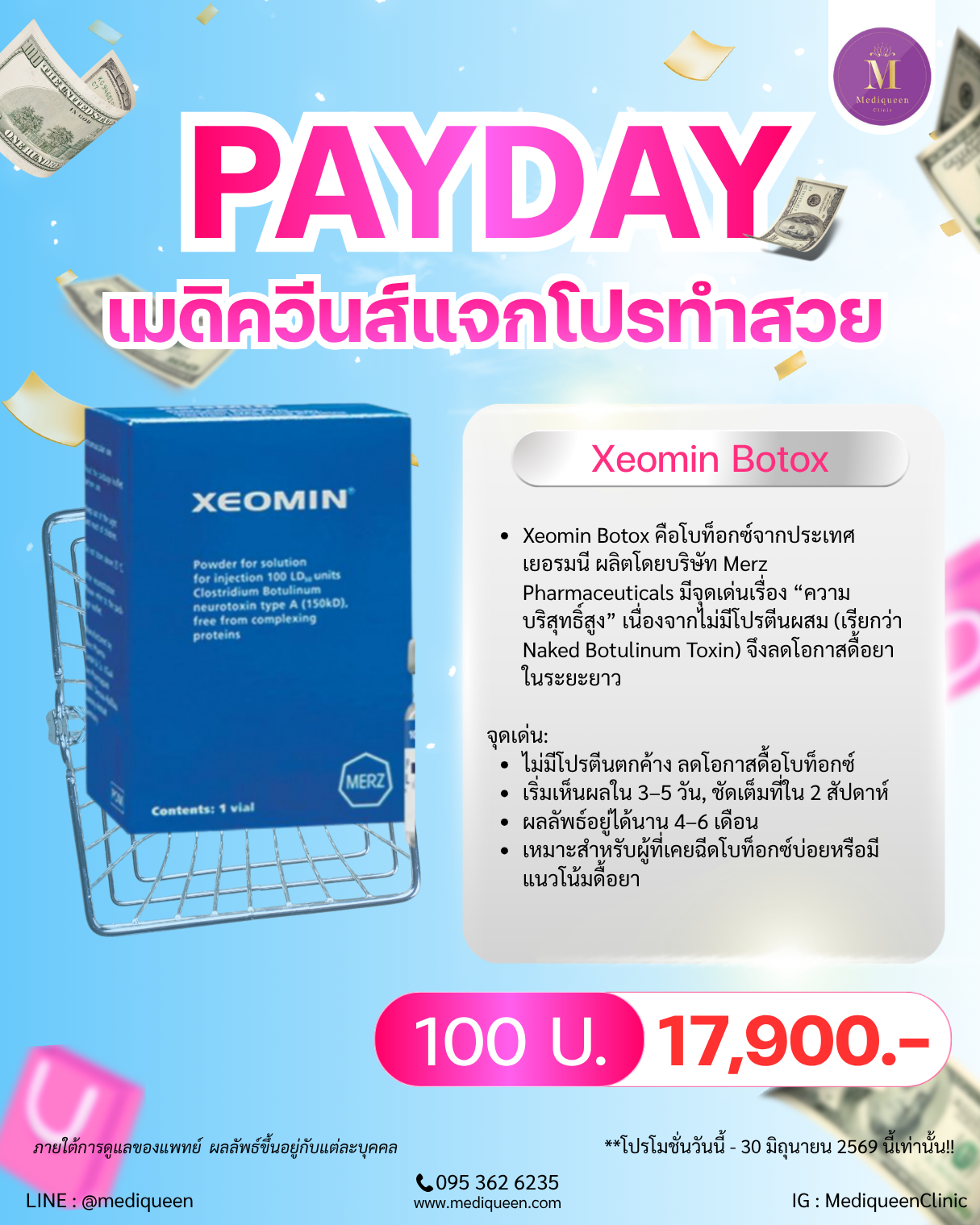 Xeomin Botox