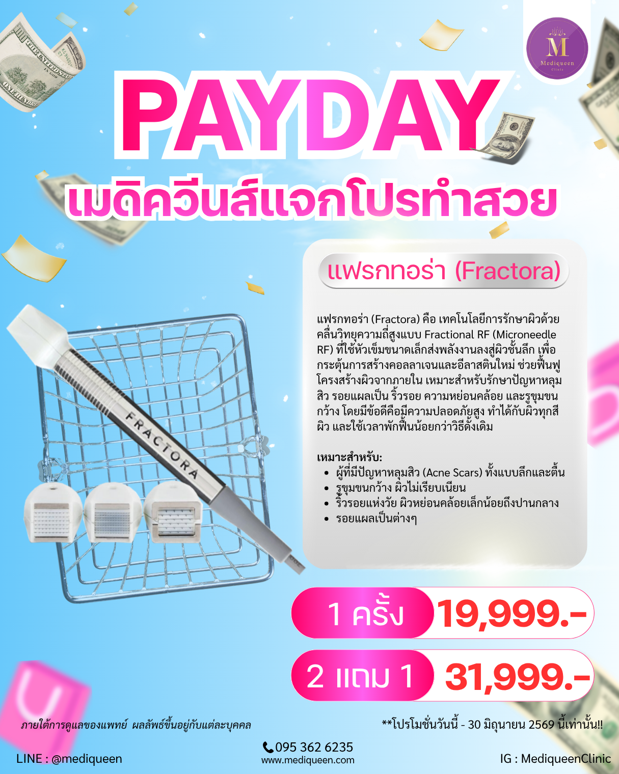 Fractora แฟรกทอร่า