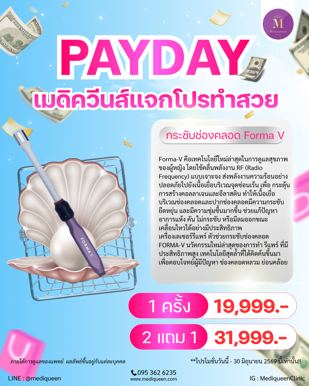 กระชับช่องคลอด Forma V