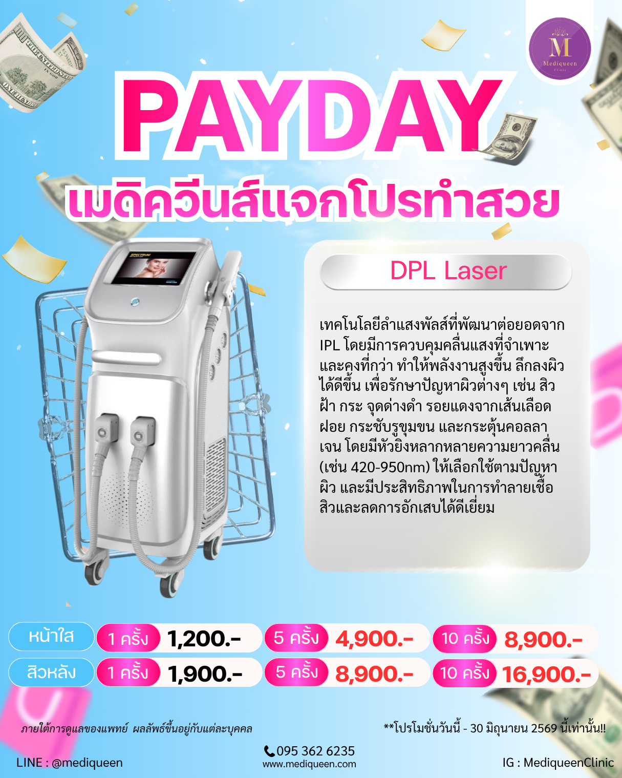 DPL Laser