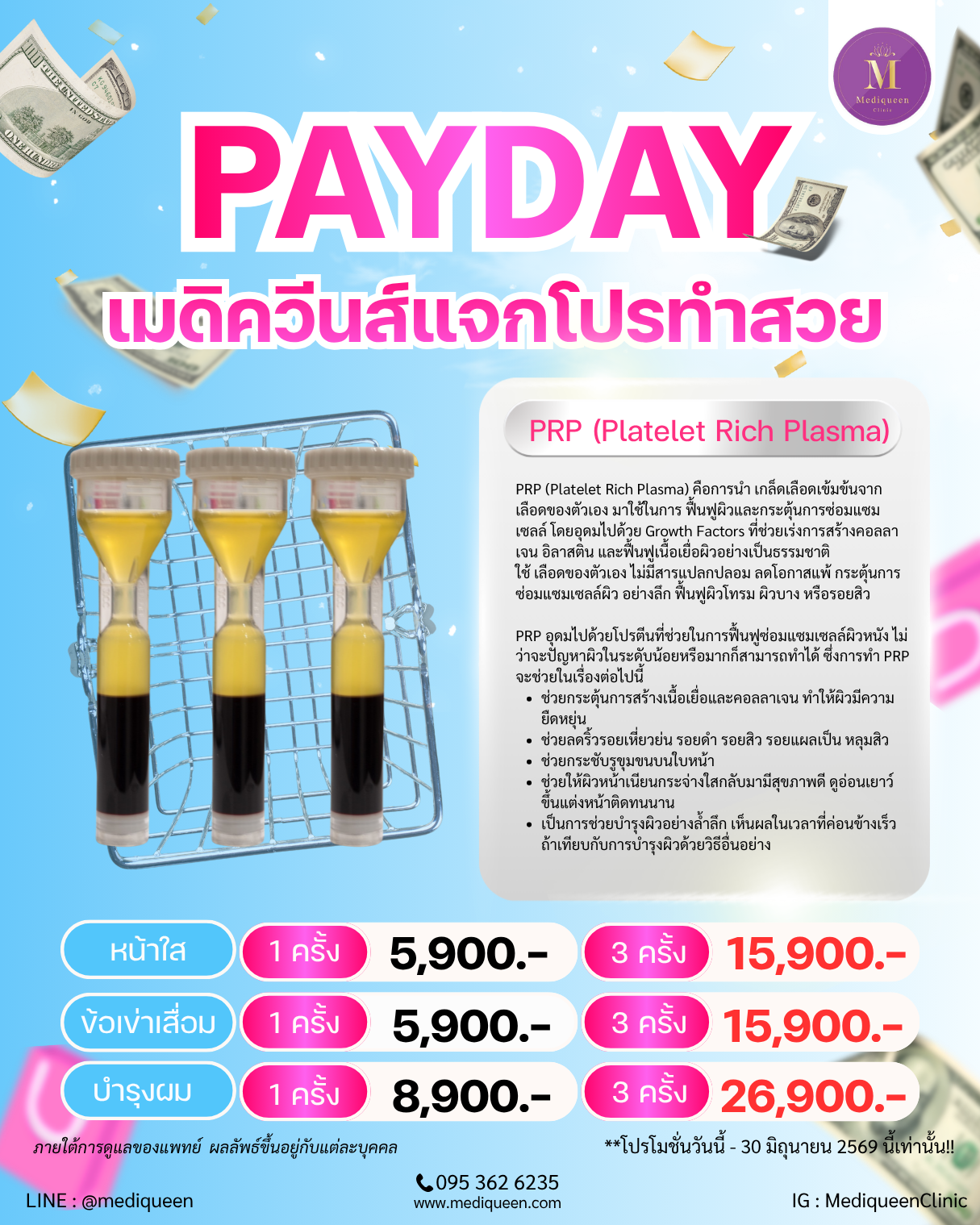 PRP (Platelet Rich Plasma)