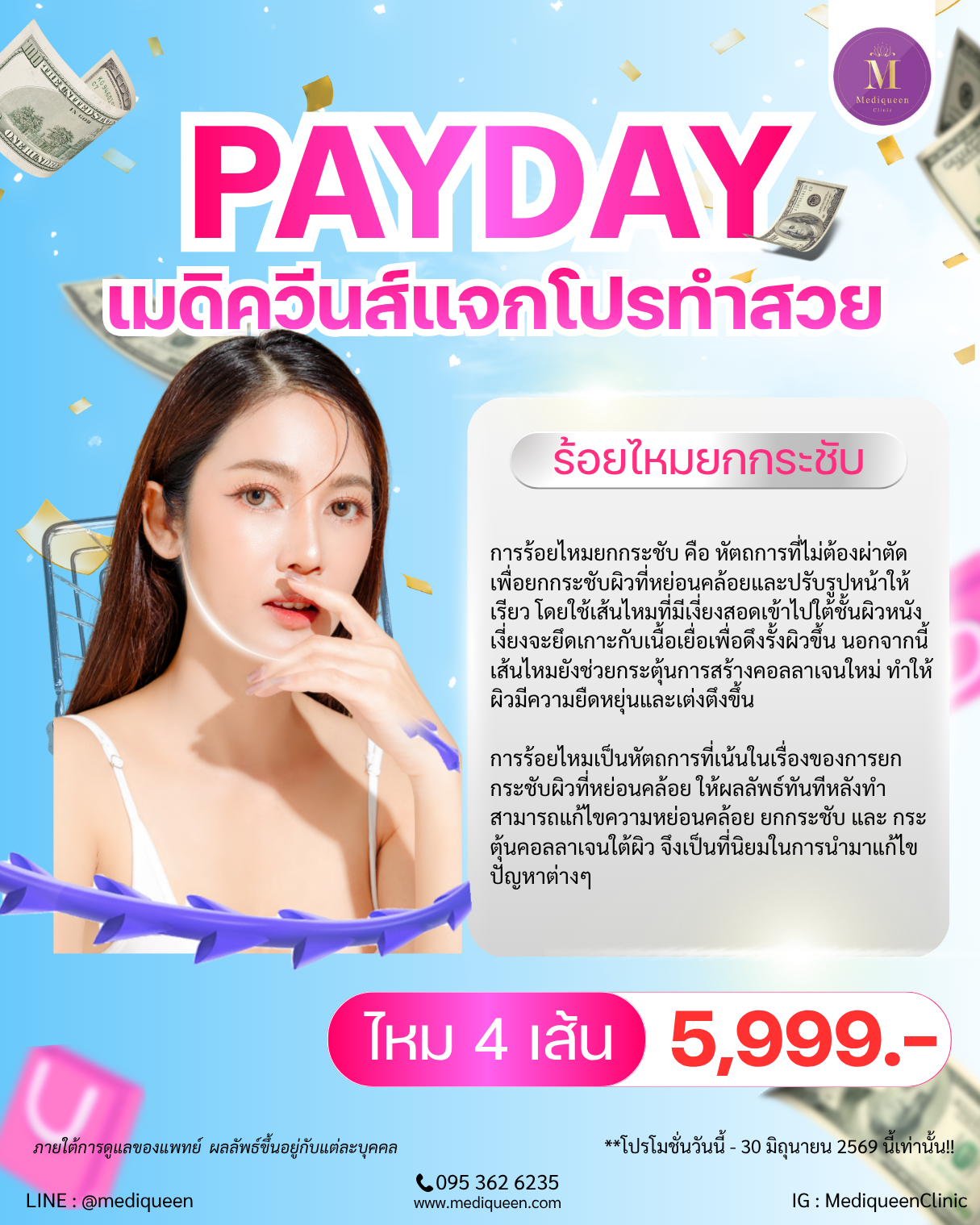 ร้อยไหมยกกระชับ 4 เส้น