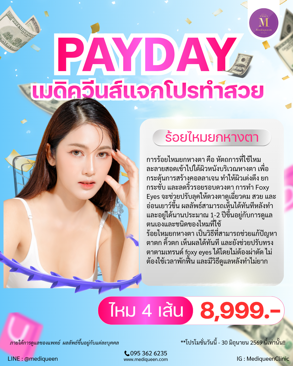 ร้อยไหมยกหางตา (Foxy Eyes Thread Lift)
