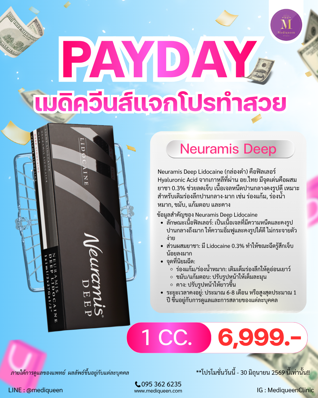 Neuramis Deep