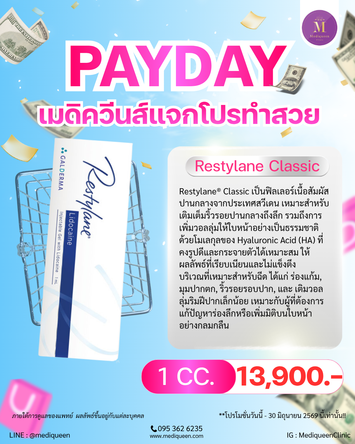 Restylane Classic