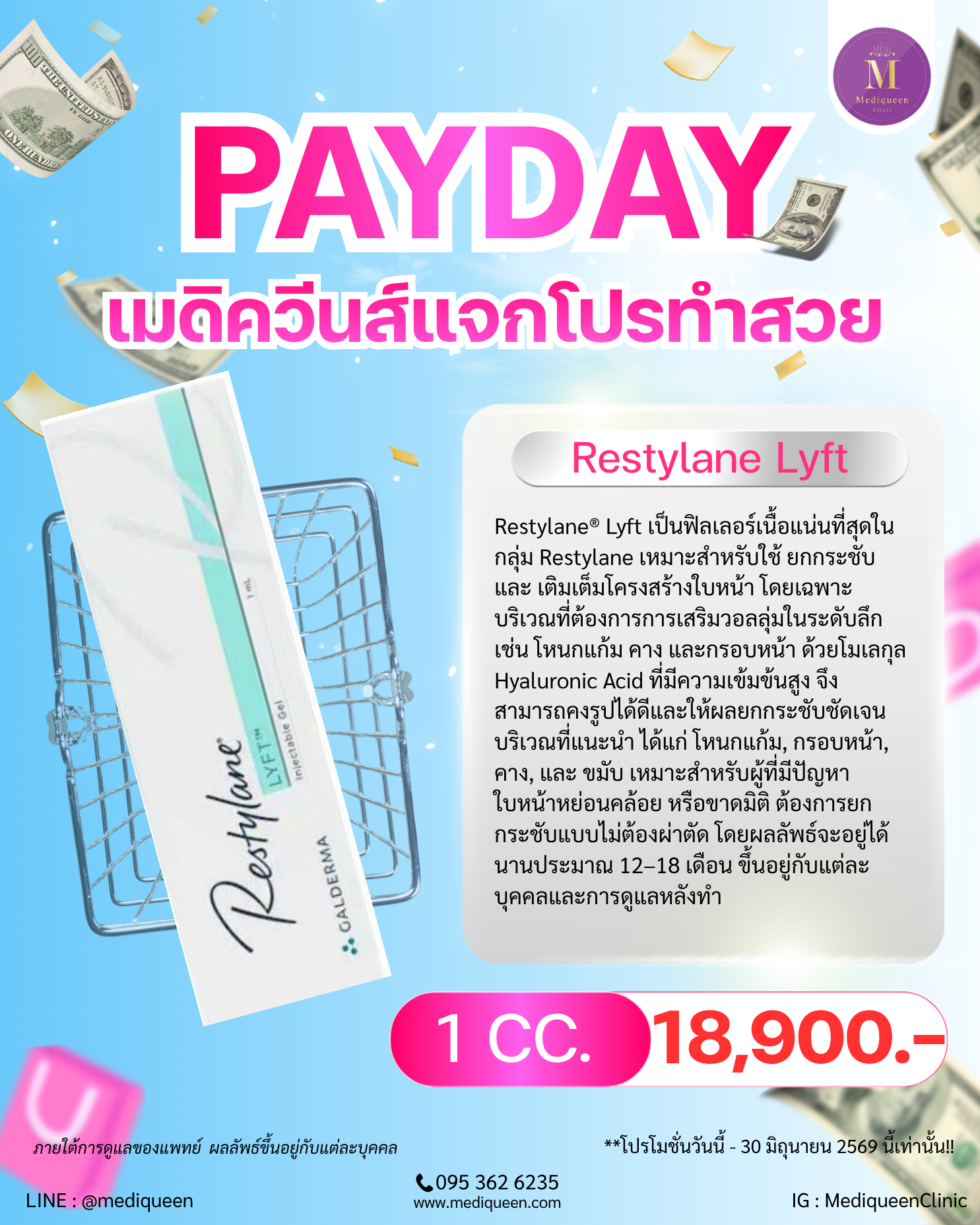 Restylane Lyft