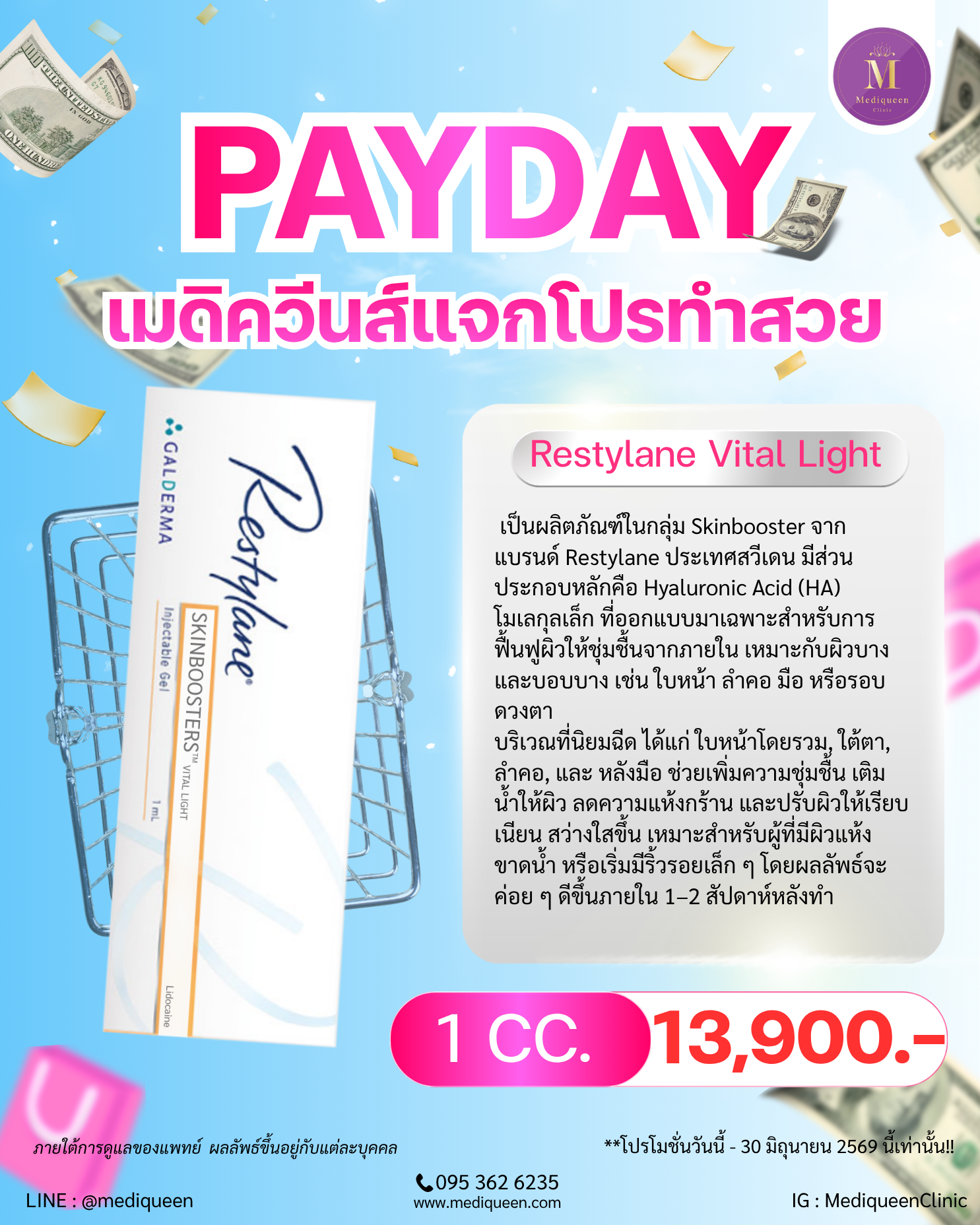 Restylane Vital Light
