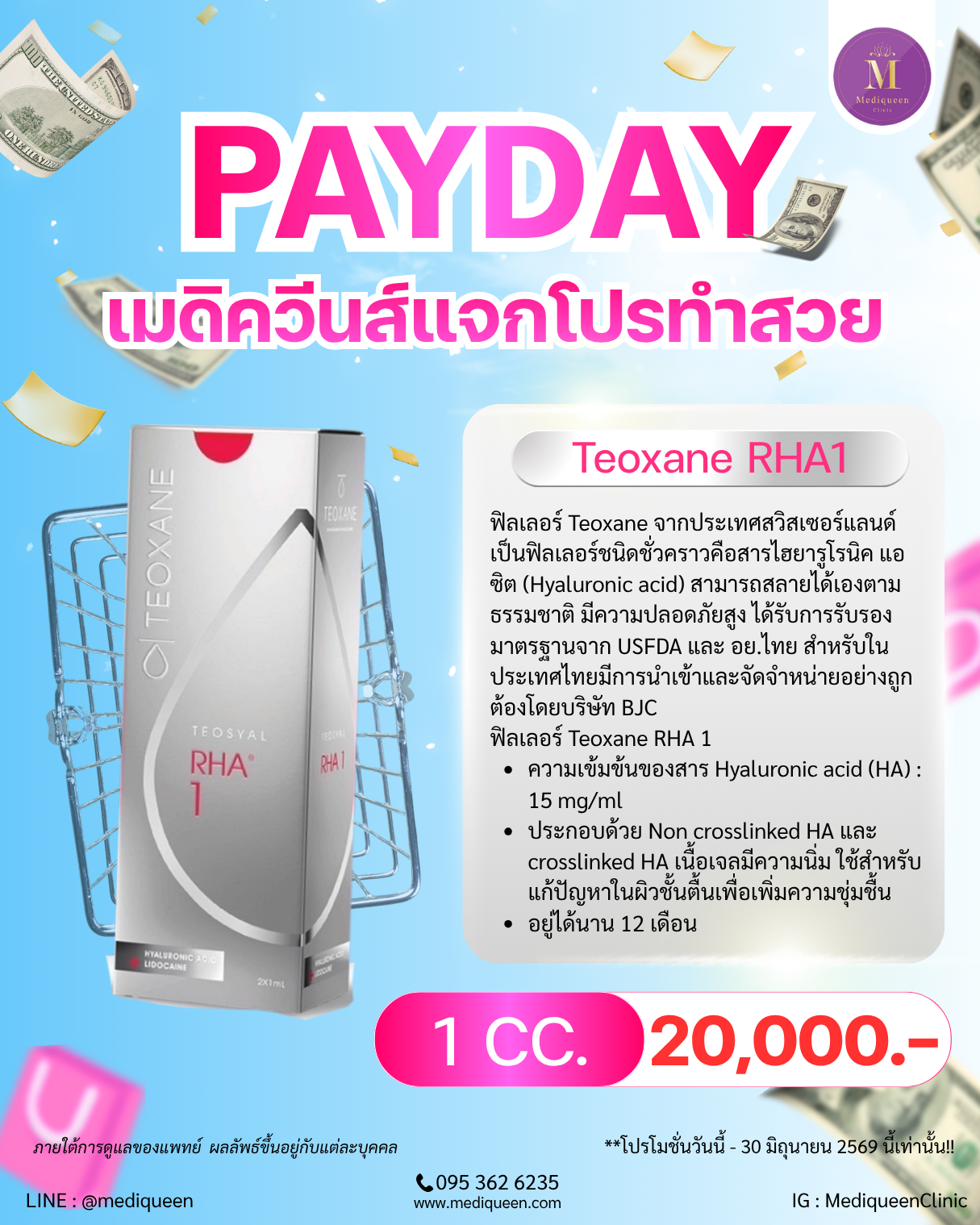 Teoxane RHA1