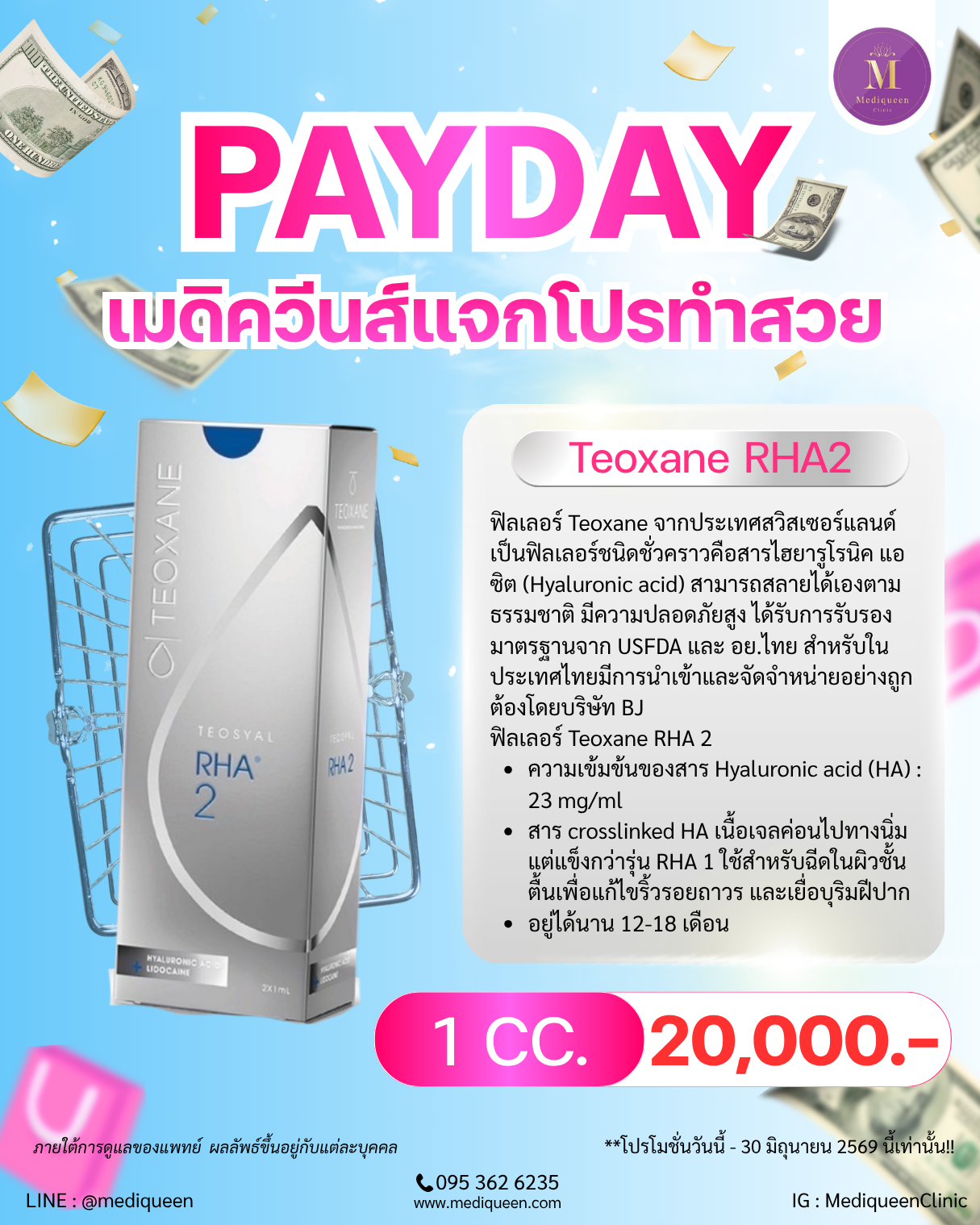 Teoxane RHA2