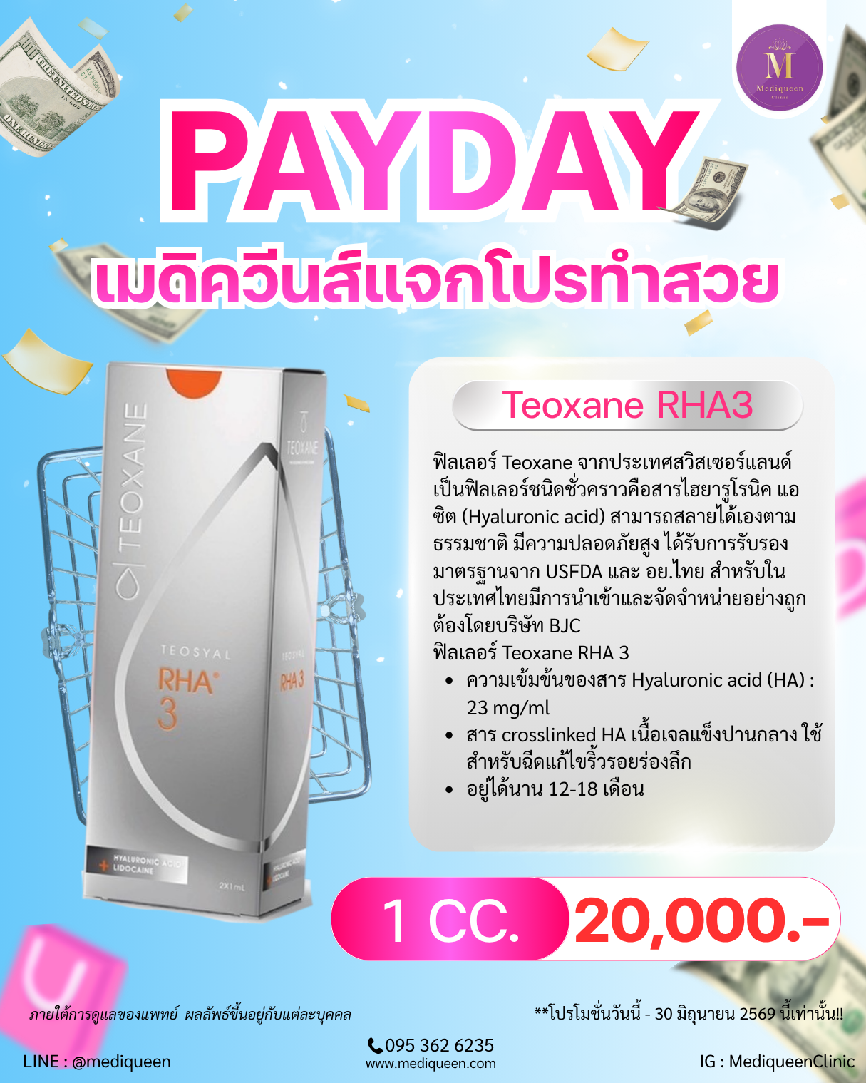 Teoxane RHA3