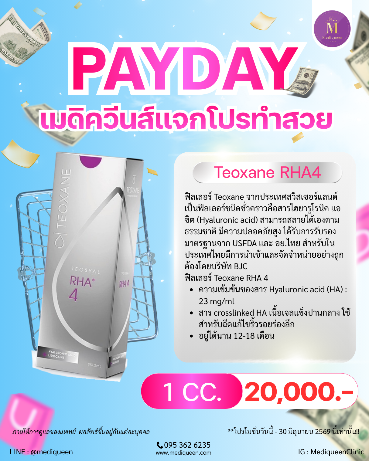Teoxane RHA4