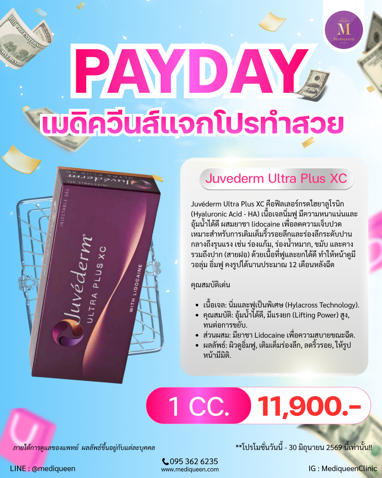 Juvederm Ultra Plus XC