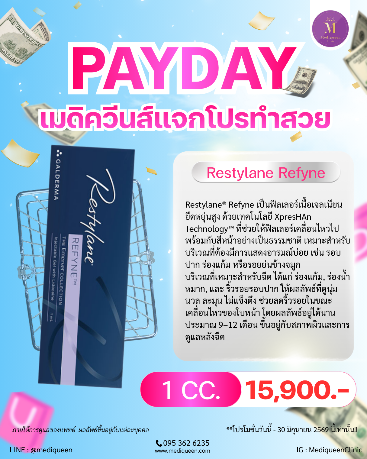 Restylane Refyne