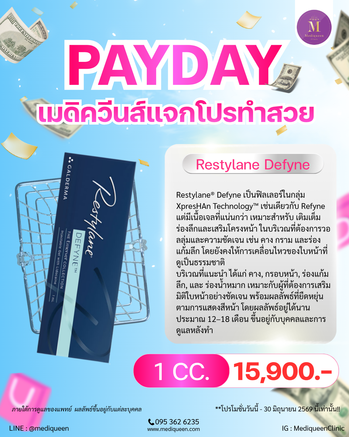 Restylane Defyne