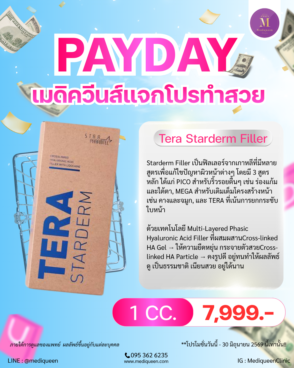 Tera Starderm Filler