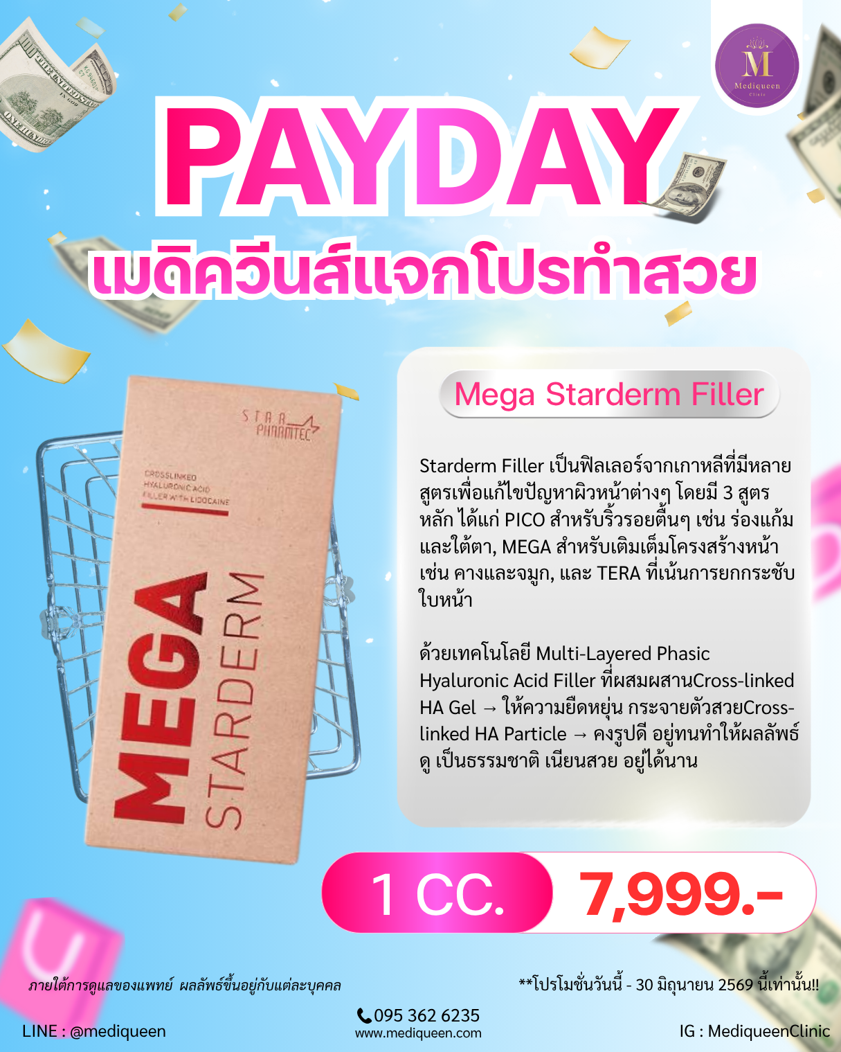Mega Starderm Filler