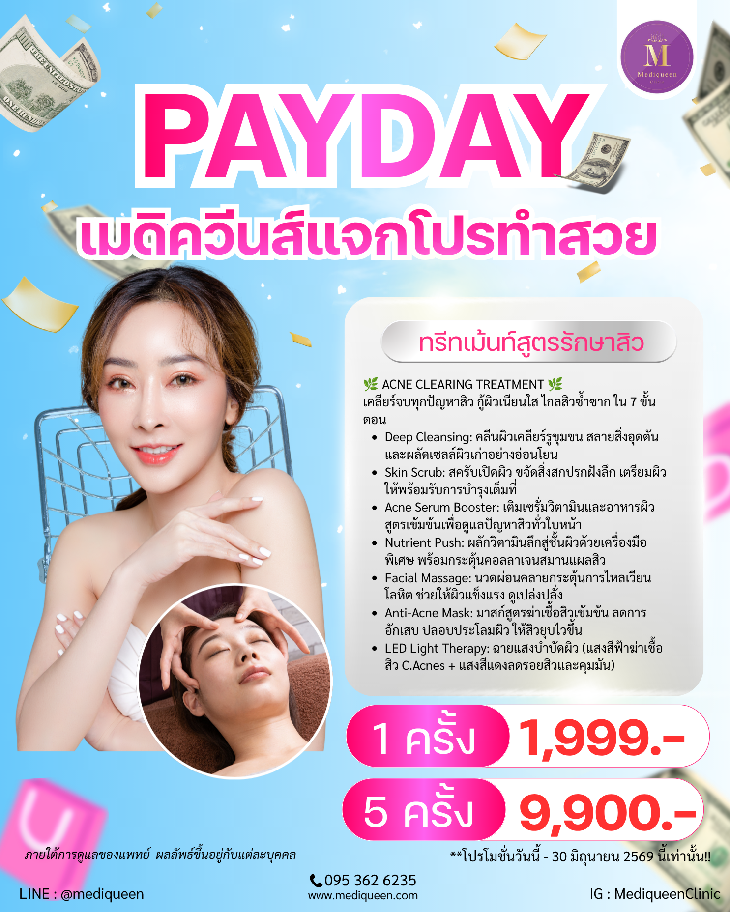 ทรีทเม้นท์สูตรรักษาสิว 1 ครั้ง