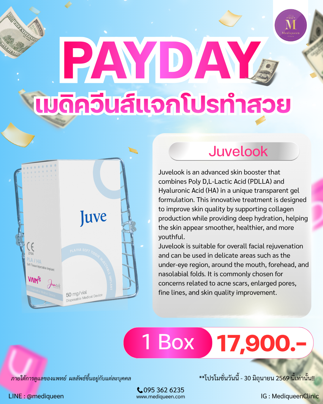 Juvelook
