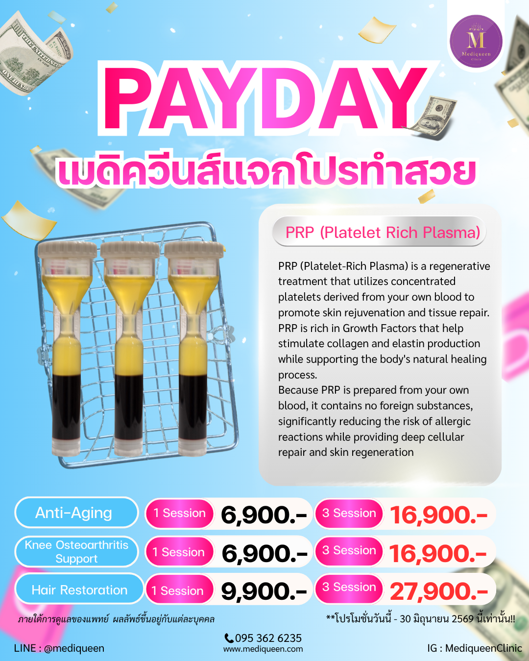 PRP (Platelet-Rich Plasma) Therapy