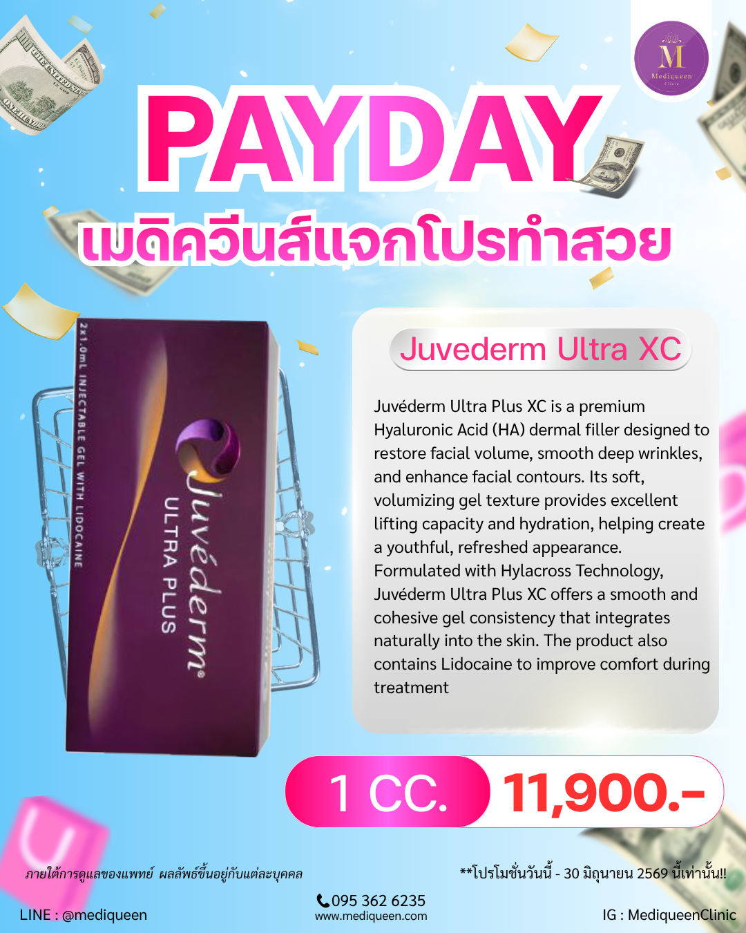 Juvéderm Ultra Plus XC