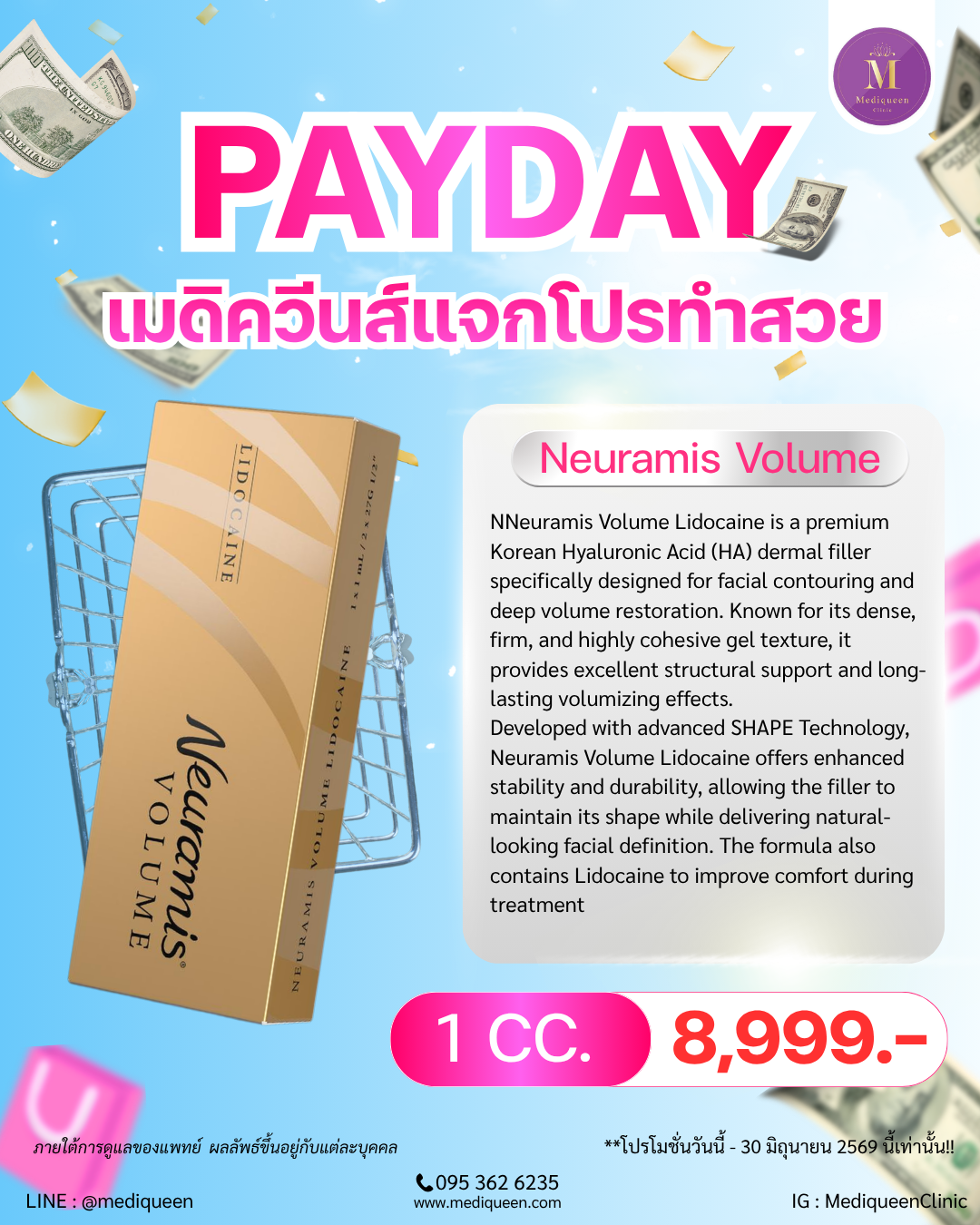 Neuramis Volume Lidocaine