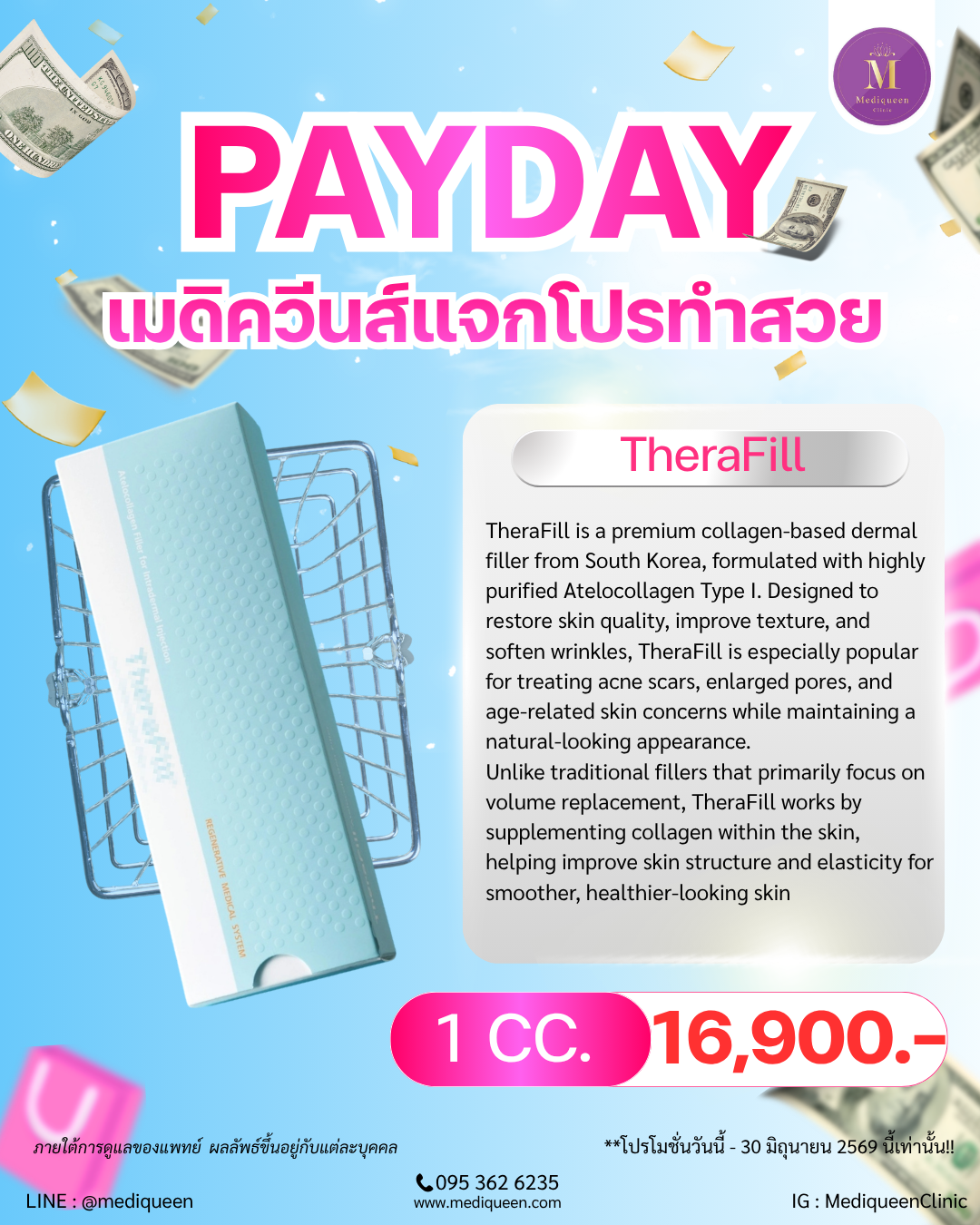 TheraFill Collagen Filler