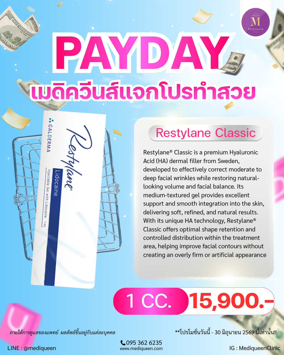 Restylane® Classic