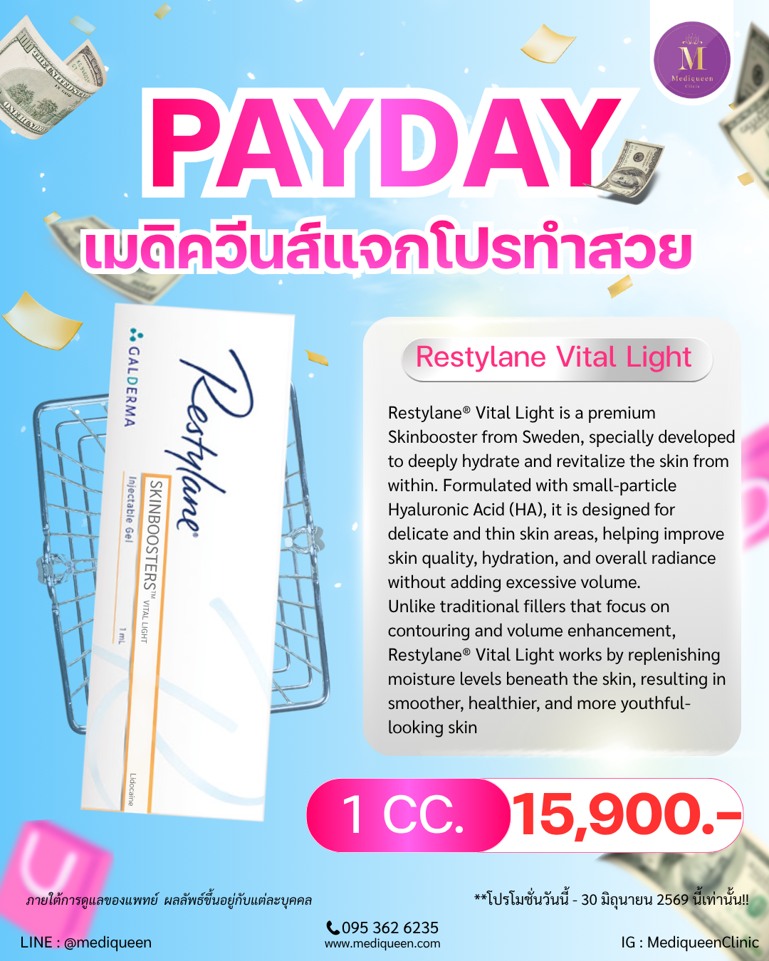 Restylane® Vital Light