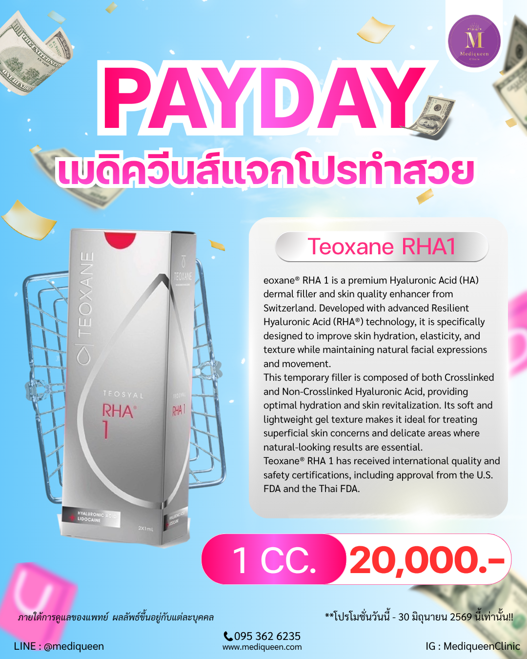 Teoxane® RHA 1