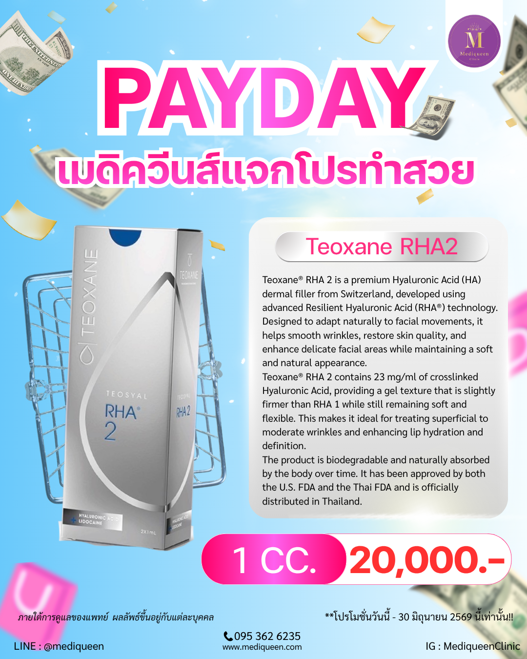 Teoxane® RHA 2