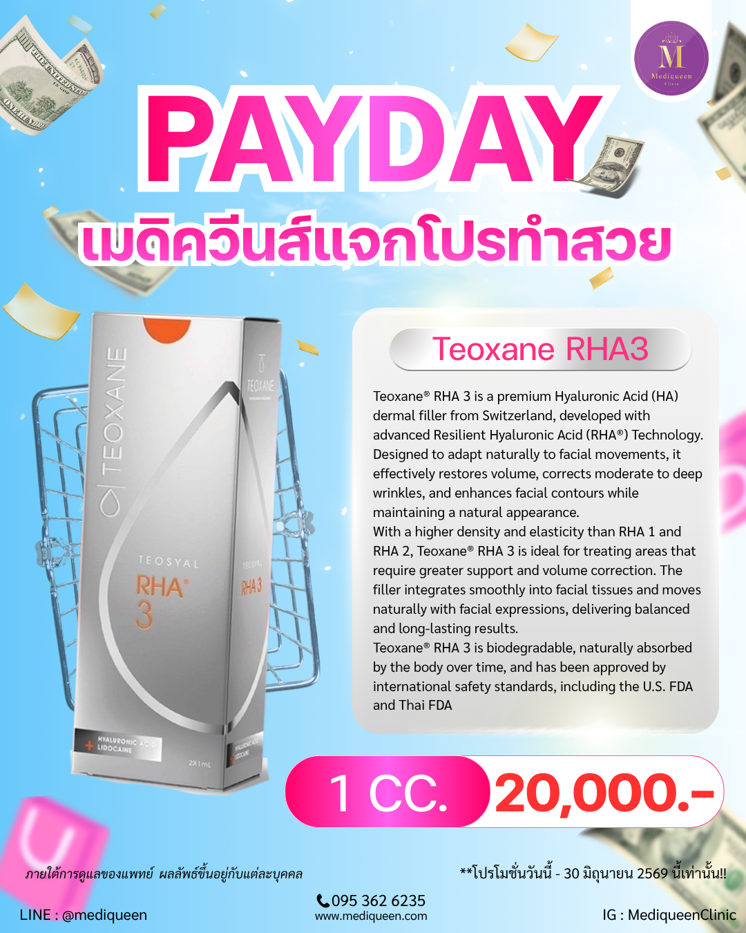 Teoxane® RHA 3