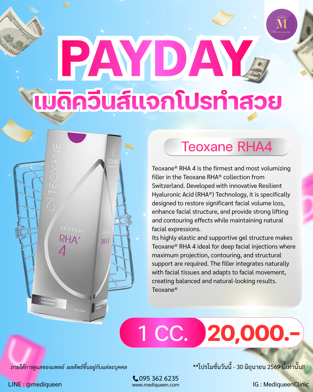 Teoxane® RHA 4