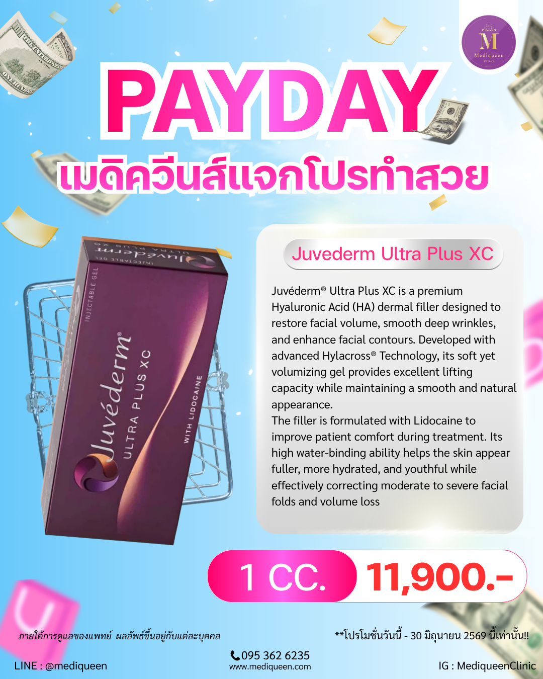 Juvéderm® Ultra Plus XC