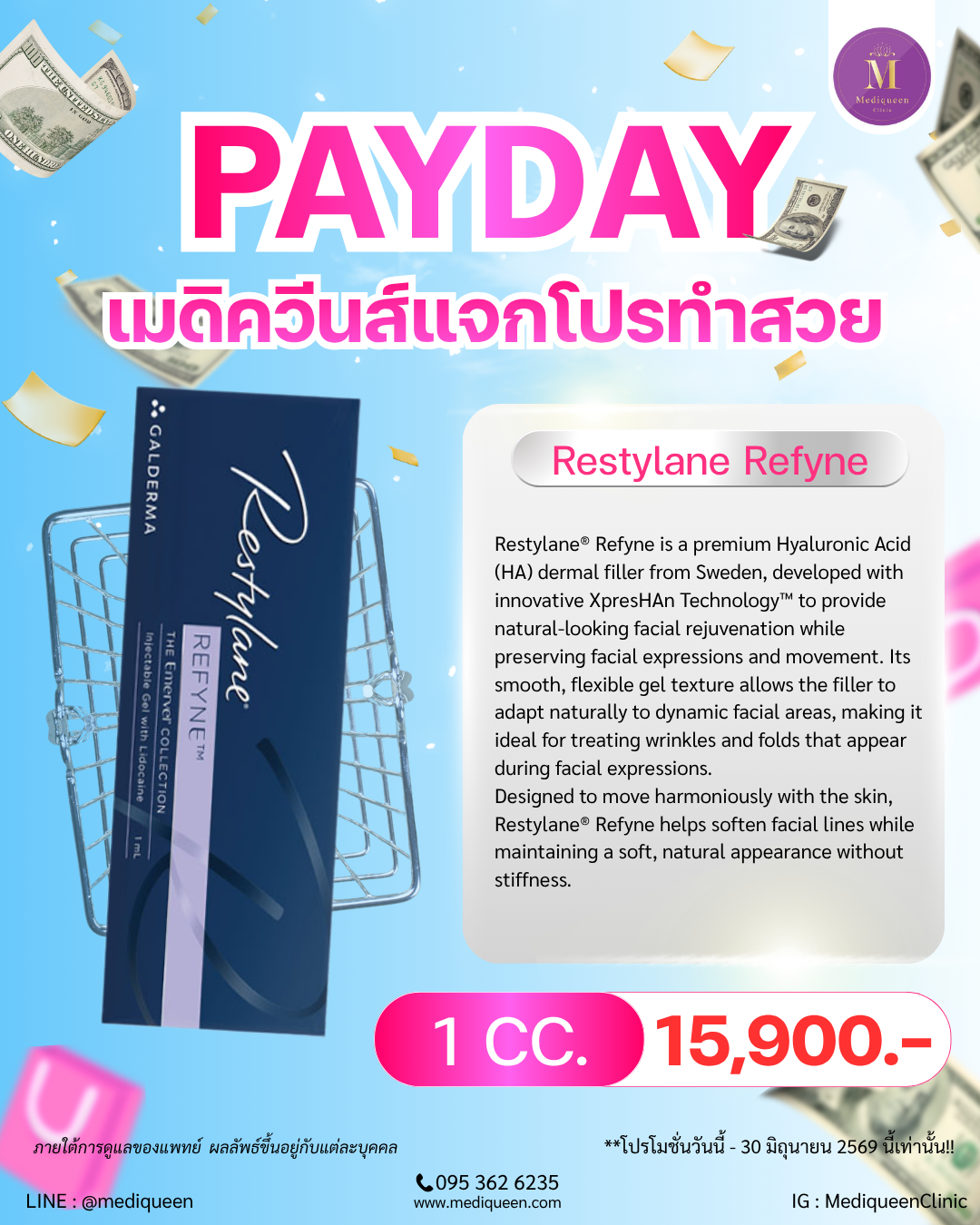 Restylane® Refyne