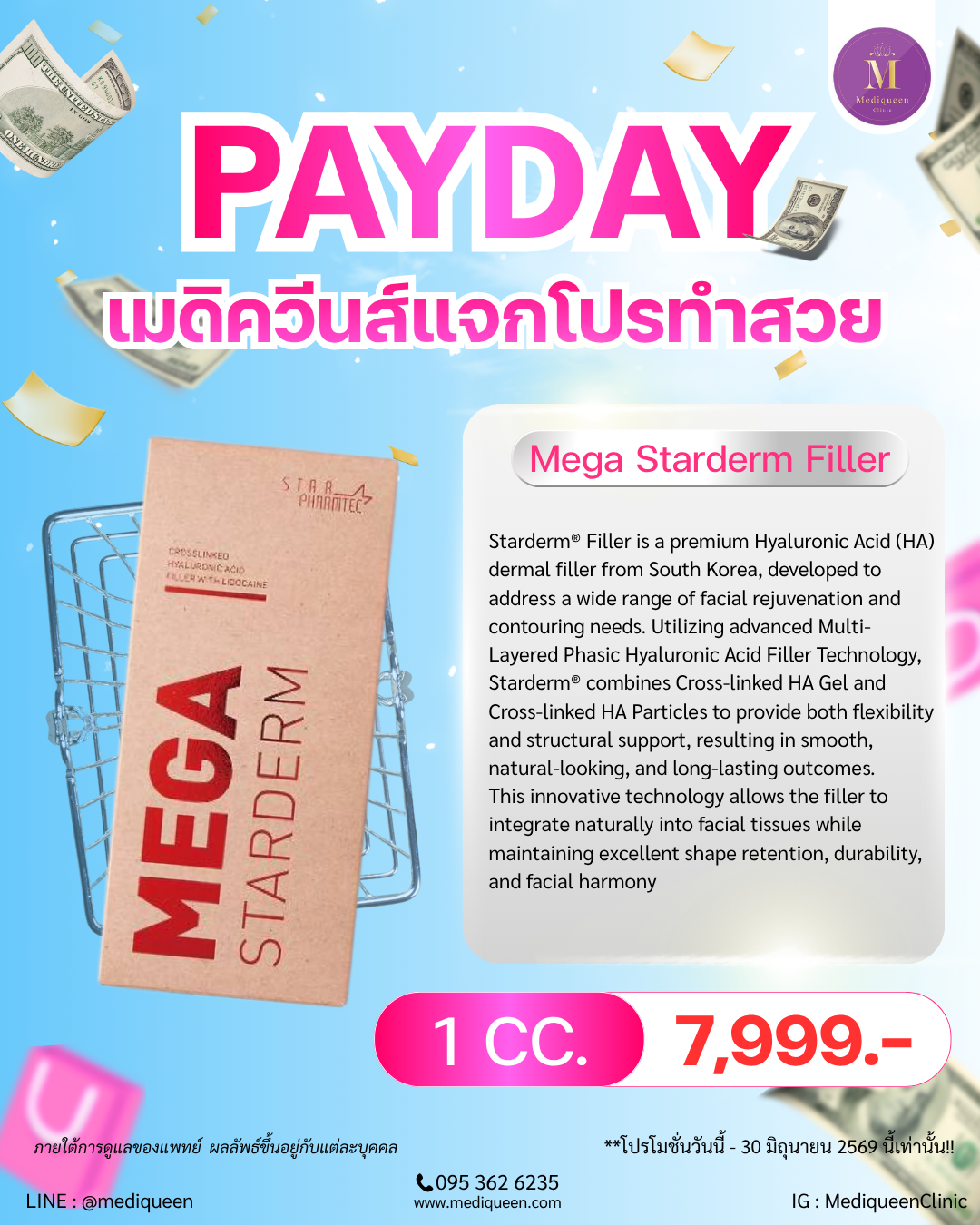 Starderm® Mega