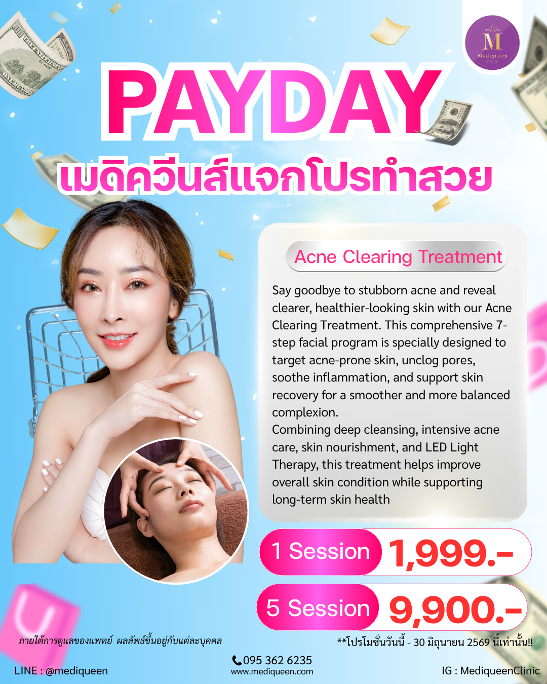 ACNE CLEARING TREATMENT