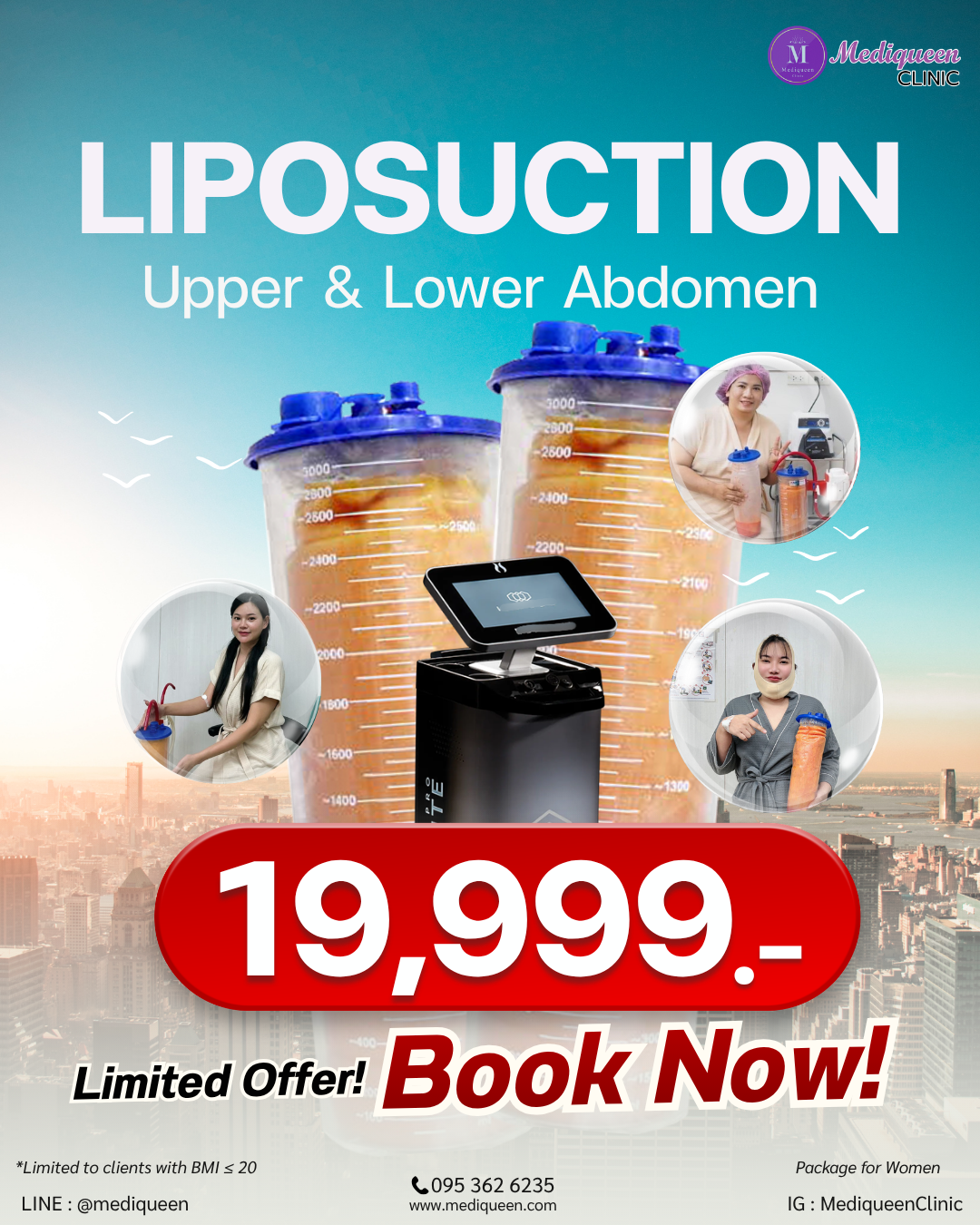 LIPOSUCTION PROMOTION Package for women